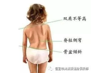 _1